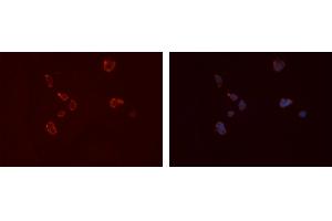 ABIN6276667 staining Hela cells by IF/ICC. (FCGR2A antibody  (C-Term))