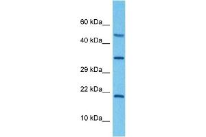 Host:  Rabbit  Target Name:  ATP6V0C  Sample Tissue:  Human RPMI 8226 Whole Cell  Antibody Dilution:  1ug/ml (ATP6V0C antibody  (Middle Region))