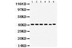 Western Blotting (WB) image for anti-Chemokine (C-X-C Motif) Receptor 2 (CXCR2) (AA 196-212), (Middle Region) antibody (ABIN3043018) (CXCR2 antibody  (Middle Region))