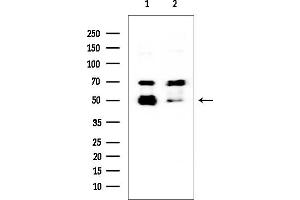 anti-Solute Carrier Family 39 (Zinc Transporter), Member 7 (SLC39A7) antibody