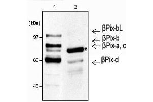 Western blot analysis using anti-β-Pix (mouse), pAb . (ARHGEF7 antibody)