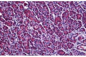 Human Pancreas: Formalin-Fixed, Paraffin-Embedded (FFPE) (Ataxin 1 antibody  (AA 742-791))