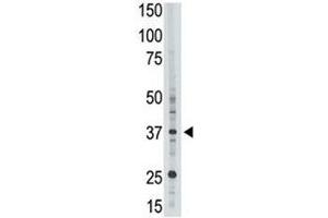 EPR1 antibody used in western blot to detect EPR1 in HL-60 cell lysate (EPR1 antibody  (AA 308-337))