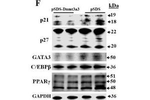 Dnmt3a3 overexpression decreases fat accumulation in differentiating preadipocytes. (CDKN1B antibody  (AA 150-198))