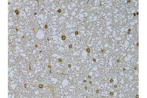 Immunohistochemistry of paraffin-embedded rat spleen using HDGFRP3 Rabbit pAb (ABIN6133452, ABIN6141699, ABIN6141700 and ABIN6224799) at dilution of 1:150 (40x lens). (HDGFRP3 antibody  (AA 90-203))