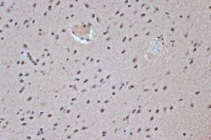 Immunohistochemistry of paraffin-embedded rat brain using SRSF3 Rabbit mAb (ABIN7270216) at dilution of 1:100 (40x lens). (SRSF3 antibody)