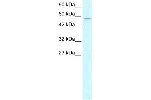 WB Suggested Anti-CCNL1 Antibody Titration: 2. (Cyclin L1 antibody  (N-Term))