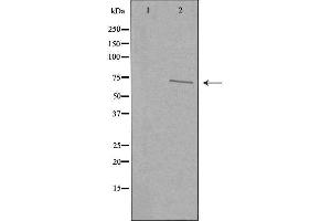 Western blot analysis of extracts from COLO205 cells, using CDKAL antibody. (CDKAL1 antibody  (N-Term))