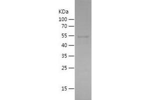 Western Blotting (WB) image for Sortilin 1 (SORT1) (AA 532-831) protein (His-IF2DI Tag) (ABIN7125175) (Sortilin 1 Protein (SORT1) (AA 532-831) (His-IF2DI Tag))