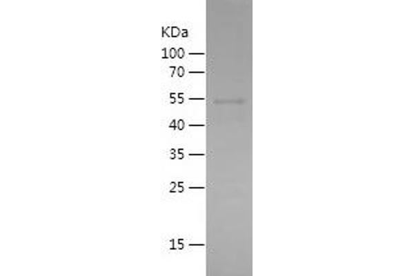 Sortilin 1 Protein (SORT1) (AA 532-831) (His-IF2DI Tag)