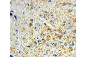 Used in DAB staining on fromalin fixed paraffin-embedded Brain tissue (Dermatopontin antibody  (AA 26-197))