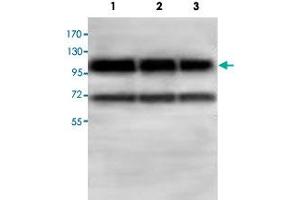 Western blot analysis of HepG2 (Lane 1) and 293T (Lane 2) and HeLa cell lysates with ABCF1 polyclonal antibody  at 1 : 500 dilution. (ABCF1 antibody  (AA 580-837))