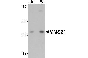 Western blot analysis of MMS21 in 293 cell lysate with MMS21 antibody at (A) 0. (NSMCE2 antibody  (C-Term))