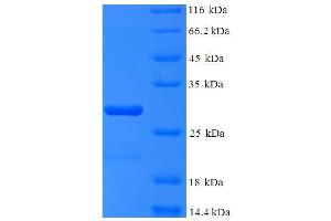 SDS-PAGE (SDS) image for Polymerase (RNA) III (DNA Directed) Polypeptide K, 12.3 KDa (POLR3K) (AA 1-108), (full length) protein (His-SUMO Tag) (ABIN4975631)