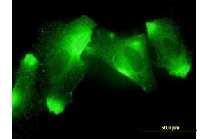 Immunofluorescence of monoclonal antibody to MFRP on HeLa cell. (MFRP antibody  (AA 480-579))