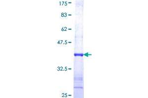 NOS2 Protein (AA 685-794) (GST tag)