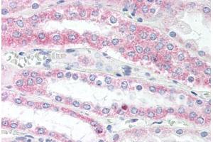 Human Kidney (formalin-fixed, paraffin-embedded) stained with VAMP5 antibody ABIN337073 at 10 ug/ml followed by biotinylated goat anti-rabbit IgG secondary antibody ABIN481713, alkaline phosphatase-streptavidin and chromogen. (VAMP5 antibody  (N-Term))