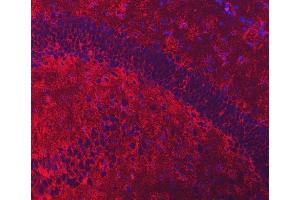 IF analysis of EAAT2/GLT-1/SLC1A2 using anti-EAAT2/GLT-1/SLC1A2 antibody (ABIN3043436).