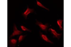ABIN6269325 staining NIH-3T3 by IF/ICC. (PKC zeta antibody  (C-Term))