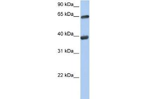 WB Suggested Anti-TKT Antibody Titration:  0. (TKT antibody  (N-Term))