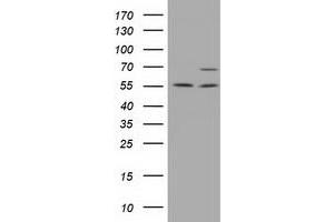 Western Blotting (WB) image for anti-Membrane Protein, Palmitoylated 3 (MAGUK P55 Subfamily Member 3) (MPP3) antibody (ABIN1499548) (MPP3 antibody)