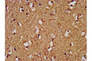 IHC image of ABIN7154814 diluted at 1:200 and staining in paraffin-embedded human brain tissue performed on a Leica BondTM system. (HEY1 antibody  (AA 200-300))