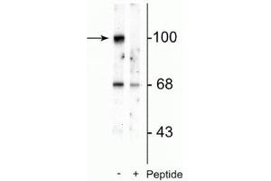 Western blot of rat brain lysate showing specific immunolabeling of the ~100 kDa GluR2 protein phosphorylated at Ser880 in the first lane (-). (GRIA2 antibody  (pSer880))