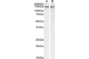 ABIN6391368 (0. (CTCF antibody  (Internal Region))