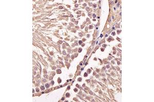 Immunohistochemical analysis of paraffin-embedded M. (Cyclin B1 antibody  (AA 103-130))
