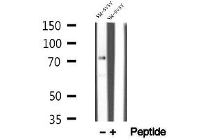 Western blot analysis of extracts of SH-SY5Y cells, using MECP2 antibody. (MECP2 antibody  (C-Term))
