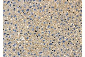ABIN6258662 and ABIN6275251 at 1/100 staining Mouse liver tissue by IHC-P.