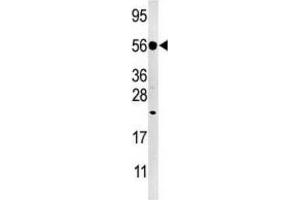 Western Blotting (WB) image for anti-Dual Specificity Phosphatase 8 (DUSP8) antibody (ABIN3003767)