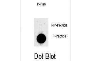 Dot Blot (DB) image for anti-Lin-28 Homolog A (C. Elegans) (LIN28A) (pSer134) antibody (ABIN3001930) (LIN28A antibody  (pSer134))