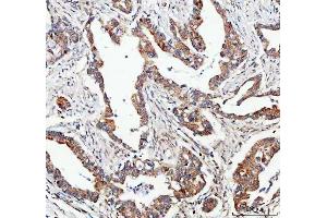 IHC analysis of FOXO3A using anti-FOXO3A antibody (ABIN3042404). (FOXO3 antibody  (AA 471-673))