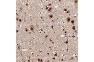 Immunohistochemical staining of human cerebral cortex with NXF5 polyclonal antibody  shows strong nuclear and moderate cytoplasmic positivity in neuronal cells at 1:10-1:20 dilution. (Nuclear RNA Export Factor 2B (NXF2B) antibody)