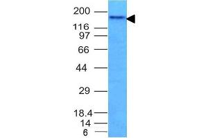 Western Blot Analysis of HCT116 cell lysate using CD56 Mouse Monoclonal Antibody (NCAM1/795). (CD56 antibody)