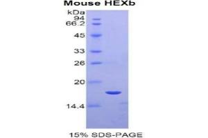 SDS-PAGE analysis of Mouse Hexosaminidase B beta Protein. (HEXB Protein)