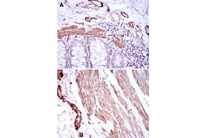 Immunohistochemical analysis of paraffin-embedded human duodenum tissues (A) and human esophagus tissues (B) using ACTA2 monoclonal antibody, clone 4A4  with DAB staining.