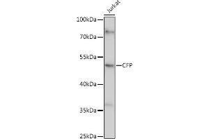 Western blot analysis of extracts of Jurkat cells, using CFP antibody (ABIN6127651, ABIN6138467, ABIN6138468 and ABIN6221045) at 1:1000 dilution. (CFP antibody  (AA 190-469))
