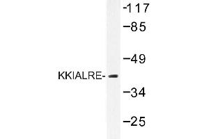Image no. 1 for anti-Cyclin-Dependent Kinase-Like 1 (CDC2-Related Kinase) (CDKL1) antibody (ABIN272207)