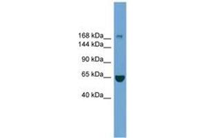 Image no. 1 for anti-Zinc Finger, CCHC Domain Containing 11 (ZCCHC11) (AA 1403-1452) antibody (ABIN6749768) (ZCCHC11 antibody  (AA 1403-1452))