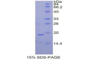 SDS-PAGE (SDS) image for Periostin (POSTN) (AA 24-173) protein (His tag) (ABIN1525548) (Periostin Protein (POSTN) (AA 24-173) (His tag))