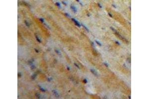 Used in DAB staining on fromalin fixed paraffin-embedded Heart tissue (MFAP5 antibody  (AA 25-152))