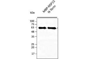 Western Blotting (WB) image for anti-SARS-CoV-2 Uridylate-Specific Endoribonuclease (NSP15) (N-Term) antibody (ABIN7273007) (SARS-CoV-2 NSP15 antibody  (N-Term))