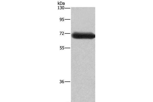 DPYSL3 antibody
