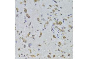 Immunohistochemistry of paraffin-embedded rat brain using RPL13 Antibody (ABIN2559760) at dilution of 1:100 (40x lens). (RPL13 antibody)