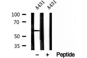 Western blot analysis of extracts of A431 cells, using HMGCS1 antibody. (HMGCS1 antibody  (Internal Region))