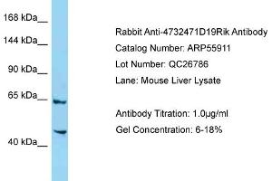 Western Blotting (WB) image for anti-SUMO-Interacting Motifs Containing 1 (SIMC1) (C-Term) antibody (ABIN2786434)