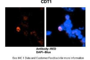 HC Suggested Anti-CDT1 antibody Titration:2 ug/ml Positive Control:Mouse brain stem cells (CDT1 antibody  (C-Term))