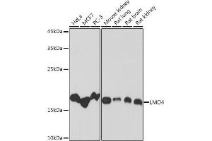 Western blot analysis of extracts of various cell lines, using LMO4 Rabbit mAb (ABIN7268258) at 1:1000 dilution. (LMO4 antibody)